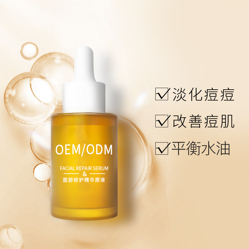 艾尚莉_祛痘精华原液OEM